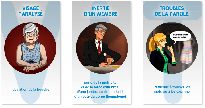 https://www.grid-france.fr/forum/img/uploads/379_avc_symptomes.png